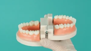 Denizli kliniğimizde uygulanan All-on-4 ve All-on-6 tam çene sabit implant tedavisi.