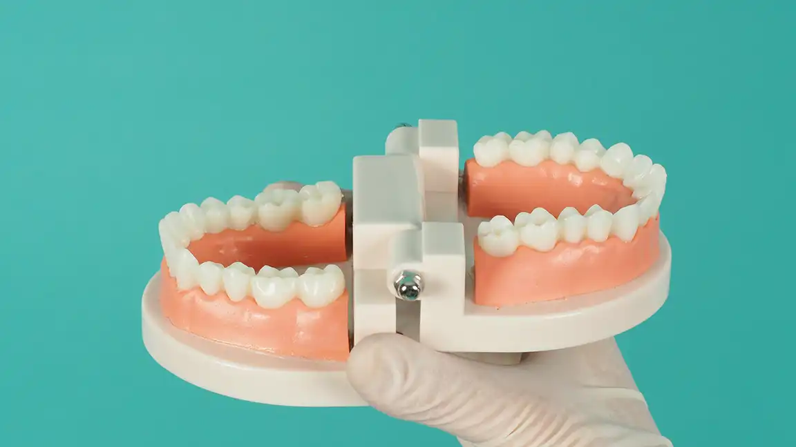 Denizli kliniğimizde uygulanan All-on-4 ve All-on-6 tam çene sabit implant tedavisi.