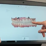 Denizli kliniğimizde gerçekleştirilen dijital gülüş tasarımı ve yüz estetiği analiz süreci.