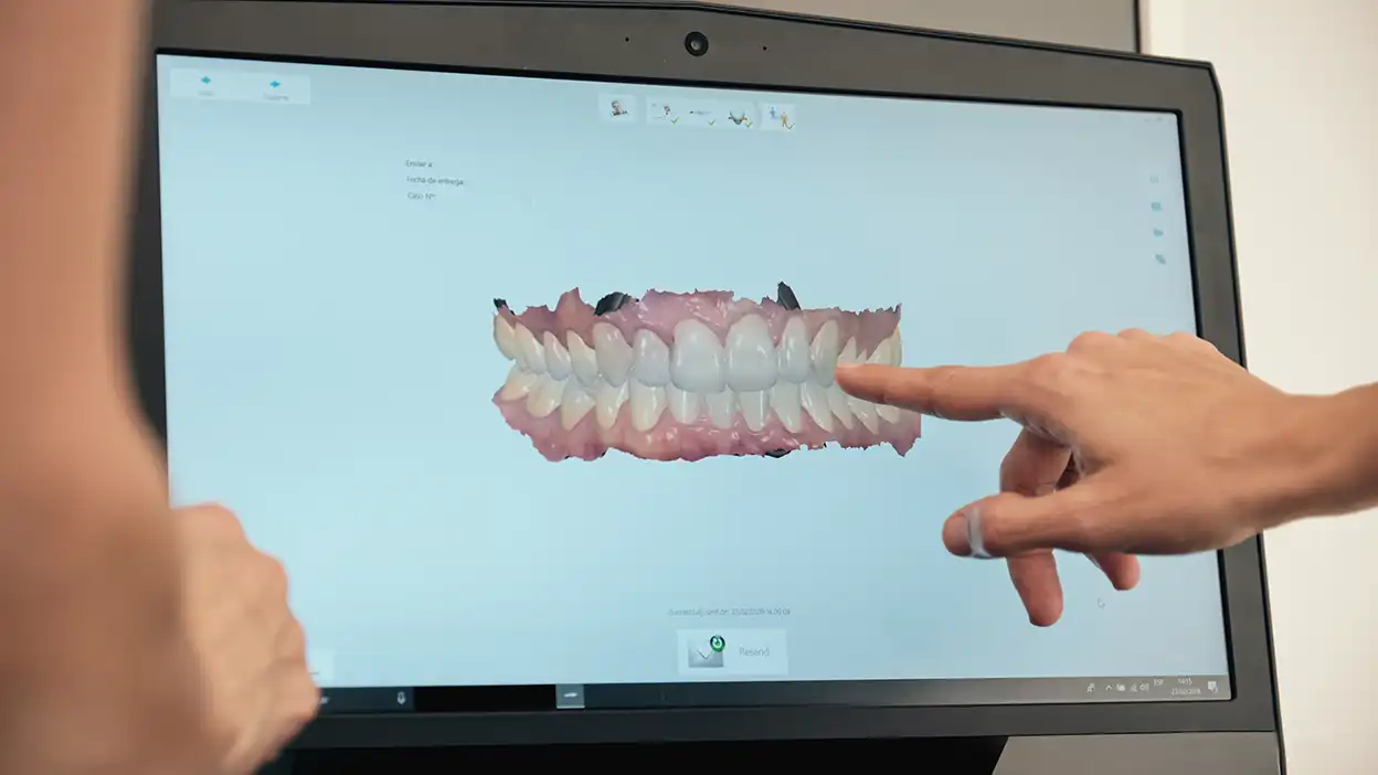 Denizli kliniğimizde gerçekleştirilen dijital gülüş tasarımı ve yüz estetiği analiz süreci.