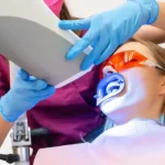 Denizli kliniğimizde uzman kontrolünde uygulanan ışık destekli profesyonel diş beyazlatma prosedürü.