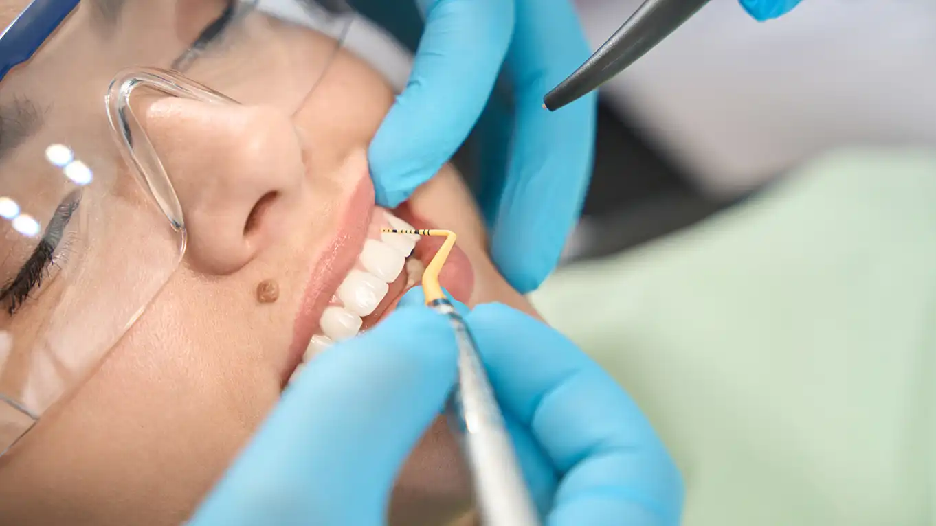 Denizli kliniğimizde uygulanan profesyonel diş taşı temizliği ve tartar temizleme aşamaları.