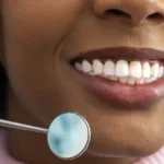 Denizli kliniğimizde uygulanan estetik restoratif diş tedavisi ve diş yapısı onarım süreçleri.