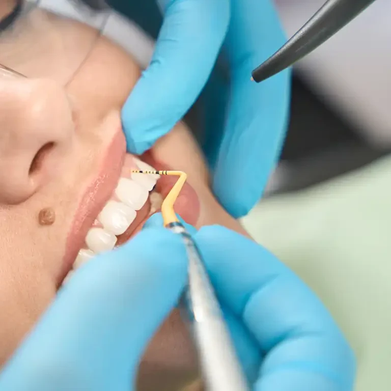 Denizli kliniğimizde uygulanan profesyonel diş taşı temizliği ve tartar temizleme aşamaları.